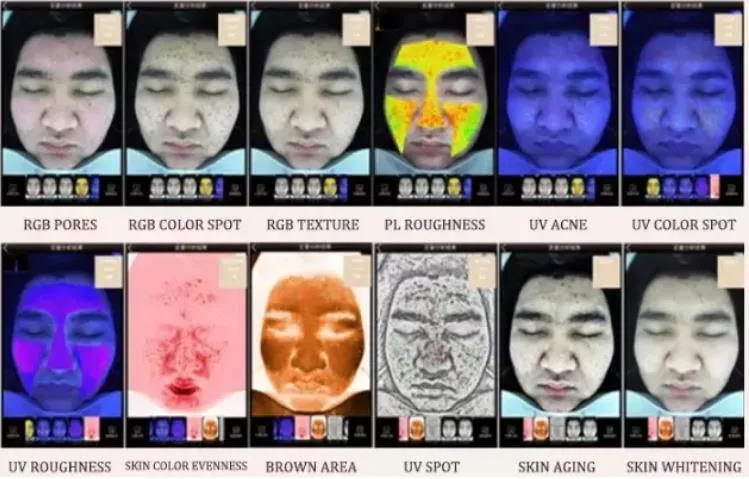 Skin Analyzer Ai Intelligent Image Digital Facial Analyzer Machine