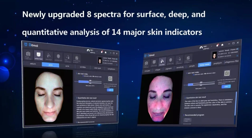 2023 Newest Intelligence Skin Analyzer with Pad for Beauty Center