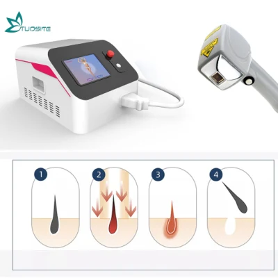 Máquina portátil de láser de picosegundos Equipo de eliminación de tatuajes Dispositivo de cáscara de láser de carbono conmutado